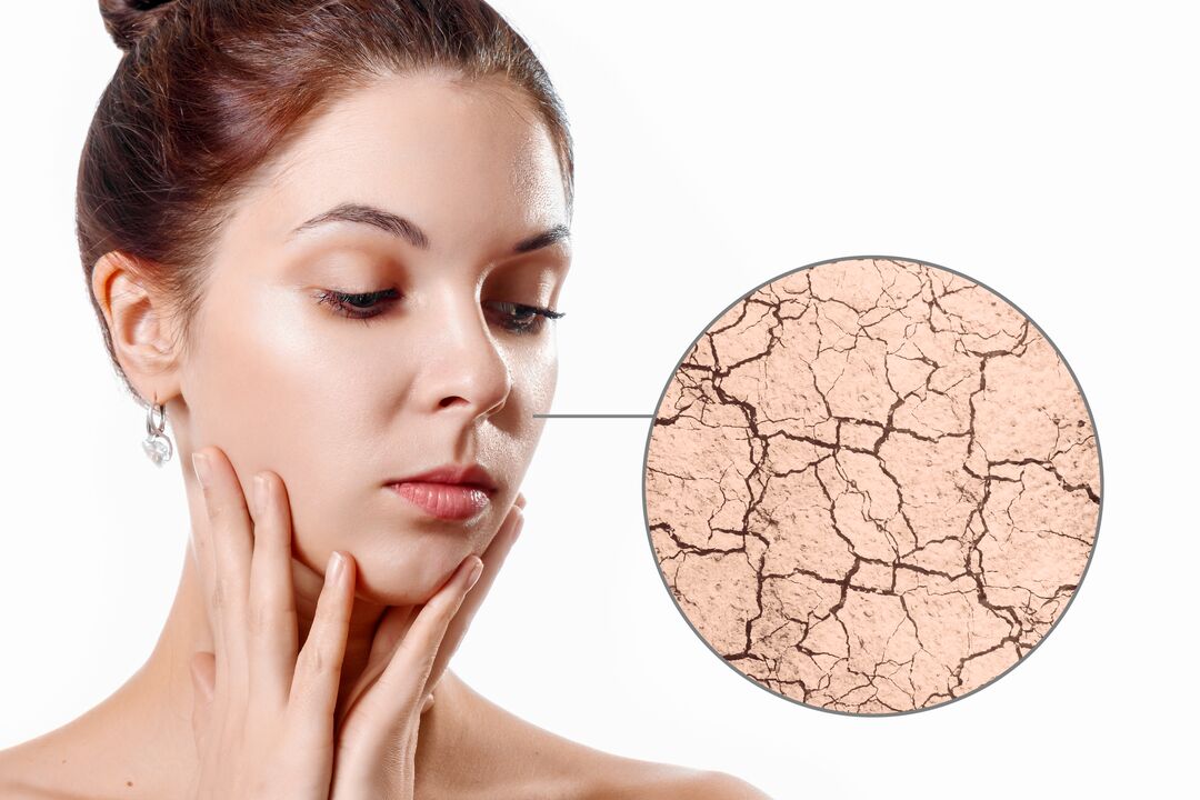 idratare la pelle secca con la crema Eudalie