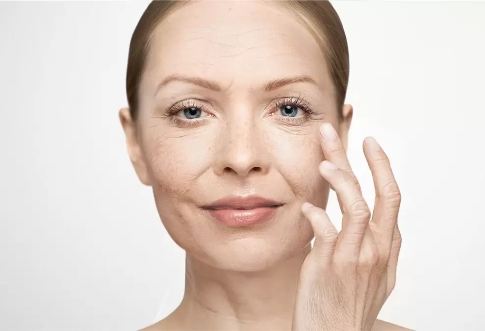 rughe del viso e loro eliminazione con la crema Eudalie
